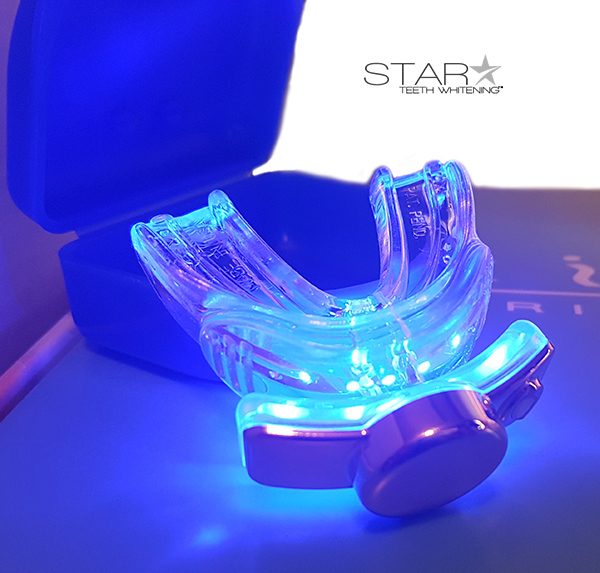 (30-Minute) At-Home Star Teeth Whitening Treatment